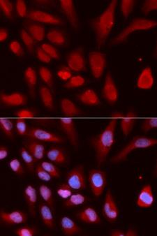 UHRF1 Antibody - Immunofluorescence analysis of U2OS cells.