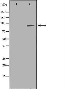 UHRF1 Antibody - Western blot analysis of HeLa whole cells lysates using UHRF1 antibody. The lane on the left is treated with the antigen-specific peptide.