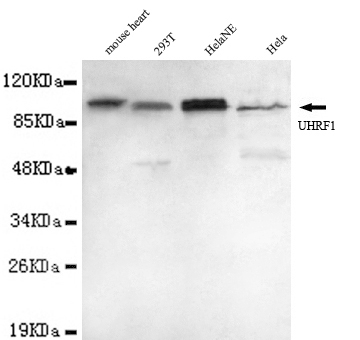 UHRF1 Antibody - UHRF1 antibody at 1/1000 dilution Lane1: mouse heart cell lysate 40 ug/lane Lane2: 293T cell lysate 40 ug/lane Lane3:HeLa NE cell lysate 40 ug/lane Lane4: HeLa cell lysate 40 ug/lane.