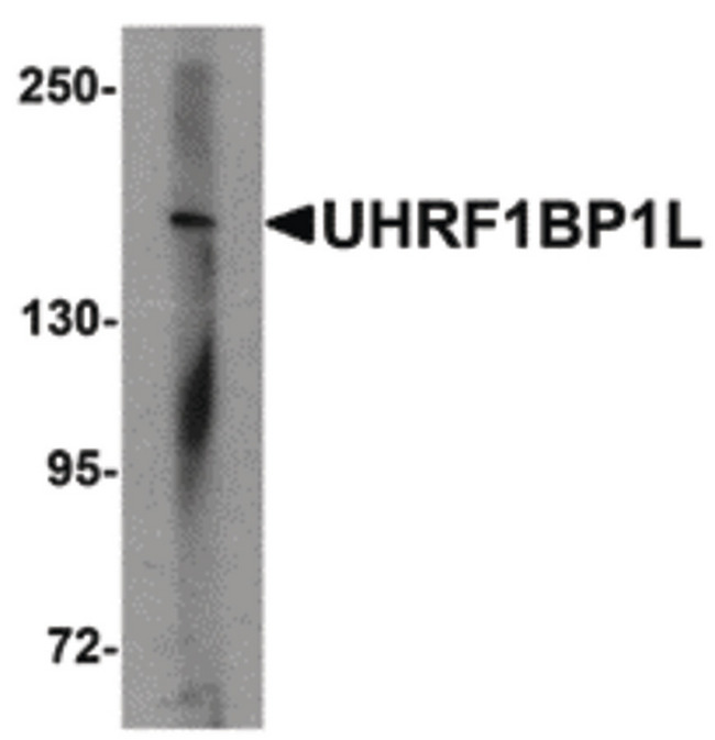 UHRF1BP1L / KIAA0701 Antibody - Western blot of UHRF1BP1L in mouse brain tissue lysate with UHRF1BP1L antibody at 1 ug/ml