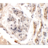 UHRF1BP1L / KIAA0701 Antibody - Immunohistochemistry of UHRF1BP1L in human kidney tissue with UHRF1BP1L antibody at 2.5 µg/mL.