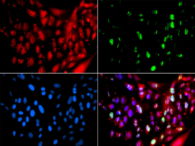 UIMC1 / RAP80 Antibody - Immunofluorescence analysis of GFP-RNF168 trangenic U2OS cells.