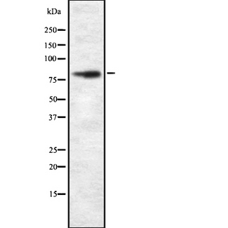 UIMC1 / RAP80 Antibody - Western blot analysis UIMC1 using COLO205 whole cells lysates
