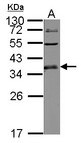 ULBP1 Antibody - Sample (30 ug of whole cell lysate) A: K562 12% SDS PAGE ULBP1 antibody diluted at 1:2000