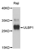 ULBP1 Antibody - Western blot analysis of extracts of Raji cells, using ULBP1 antibody at 1:1000 dilution. The secondary antibody used was an HRP Goat Anti-Rabbit IgG (H+L) at 1:10000 dilution. Lysates were loaded 25ug per lane and 3% nonfat dry milk in TBST was used for blocking. An ECL Kit was used for detection and the exposure time was 10s.