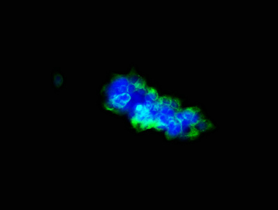 ULBP1 Antibody - Immunofluorescence staining of 293 cells with ULBP1 Antibody at 1:33, counter-stained with DAPI. The cells were fixed in 4% formaldehyde, permeabilized using 0.2% Triton X-100 and blocked in 10% normal Goat Serum. The cells were then incubated with the antibody overnight at 4°C. The secondary antibody was Alexa Fluor 488-congugated AffiniPure Goat Anti-Rabbit IgG(H+L).