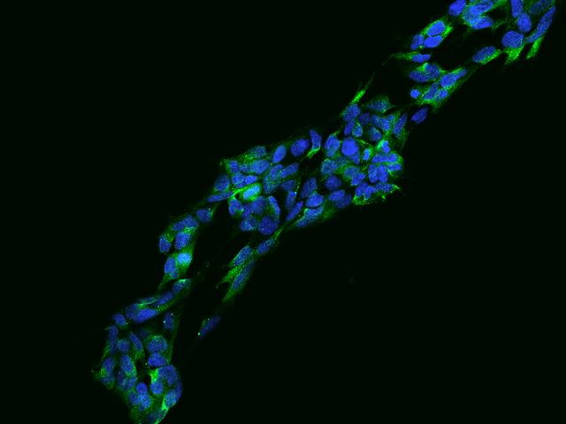 ULBP1 Antibody - Immunofluorescence staining of ULBP1 in Hek293 cells. Cells were fixed with 4% PFA, blocked with 10% serum, and incubated with rabbit anti-Human ULBP1 polyclonal antibody (dilution ratio 1:200) at 4°C overnight. Then cells were stained with the Alexa Fluor 488-conjugated Goat Anti-rabbit IgG secondary antibody (green) and counterstained with DAPI (blue). Positive staining was localized to Cytoplasm.