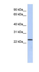 ULBP1 Antibody - ULBP1 antibody Western blot of PANC1 cell lysate. This image was taken for the unconjugated form of this product. Other forms have not been tested.