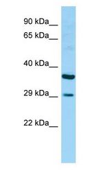 ULBP5 / RAET1G Antibody - ULBP5 / RAET1G antibody Western Blot of Fetal Heart.  This image was taken for the unconjugated form of this product. Other forms have not been tested.