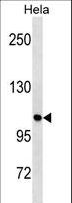 ULK1 Antibody - ULK1 Antibody (S317) western blot of HeLa cell line lysates (35 ug/lane). The ULK1 antibody detected the ULK1 protein (arrow).