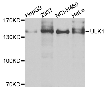 ULK1 Antibody - Western blot analysis of extracts of A2058 cells.