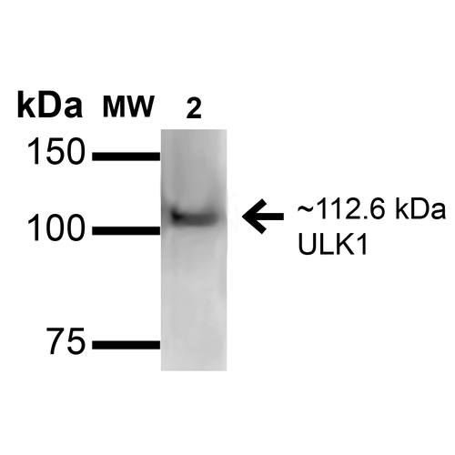 ULK1 Antibody - Western blot analysis of Rat kidney lysates showing detection of ~112.6kDa ULK1 protein using Rabbit Anti-ULK1 Polyclonal Antibody. Lane 1: Molecular Weight Ladder (MW). Lane 2: Rat kidney lysates. Load: 15 µg. Block: 2% GE Healthcare Blocker (RT, 60 minutes). Primary Antibody: Rabbit Anti-ULK1 Polyclonal Antibody  at 1:1000 for 16 hours at 4°C. Secondary Antibody: Goat Anti-Rabbit IgG: HRP at 1/2000 for 60 min at RT. Color Development: ECL solution for 6 min at RT. Predicted/Observed Size: ~112.6kDa.