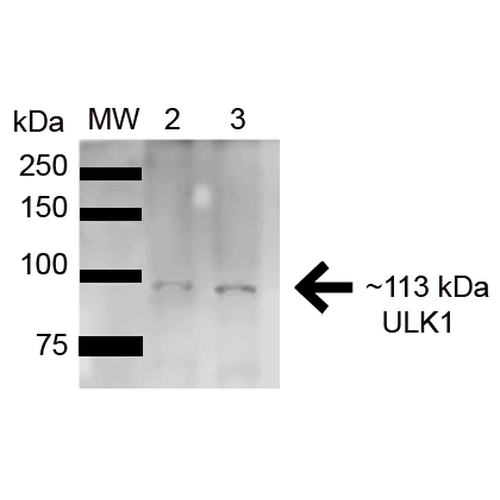 ULK1 Antibody - Western blot analysis of Human HeLa and HEK293Trap cell lysates showing detection of 112.6 kDa ULK1 protein using Rabbit Anti-ULK1 Polyclonal Antibody. Lane 1: Molecular Weight Ladder (MW). Lane 2: HeLa (15ug). Lane 3: Human 293Trap (15ug). Load: 15 µg. Block: 5% Skim Milk in 1X TBST. Primary Antibody: Rabbit Anti-ULK1 Polyclonal Antibody  at 1:1000 for 1 hour at RT. Secondary Antibody: Goat Anti-Rabbit HRP at 1:2000 for 60 min at RT. Color Development: ECL solution for 6 min in RT. Predicted/Observed Size: 112.6 kDa.