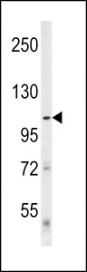 ULK1 Antibody - Western blot of Denatured ATG1 in mouse cerebellum tissue lysates (35 ug/lane). ATG1 (arrow) was detected using the purified antibody.