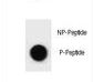 ULK1 Antibody - Dot blot of ULK1 Antibody (Phospho S317) Phospho-specific antibody on nitrocellulose membrane. 50ng of Phospho-peptide or Non Phospho-peptide per dot were adsorbed. Antibody working concentrations are 0.6ug per ml.