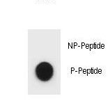 ULK1 Antibody - Dot blot of ULK1 Antibody (Phospho S467) Phospho-specific antibody on nitrocellulose membrane. 50ng of Phospho-peptide or Non Phospho-peptide per dot were adsorbed. Antibody working concentrations are 0.6ug per ml.