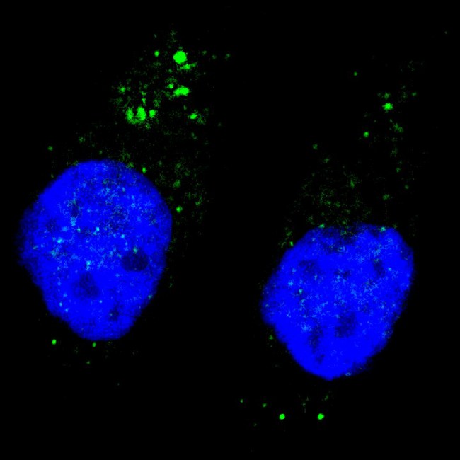 ULK1 Antibody - Fluorescent image of U251 cells stained with ULK1 (phospho S556) antibody. U251 cells were treated with Chloroquine (50 mu M,16h), then fixed with 4% PFA (20 min), permeabilized with Triton X-100 (0.2%, 30 min). Cells were then incubated ULK1 (phospho S556) primary antibody (1:200, 2 h at room temperature). For secondary antibody, Alexa Fluor 488 conjugated donkey anti-rabbit antibody (green) was used (1:1000, 1h). Nuclei were counterstained with Hoechst 33342 (blue) (10 ug/ml, 5 min). ULK1 (phospho S556) immunoreactivity is localized to autophagic vacuoles in the cytoplasm of U251 cells.