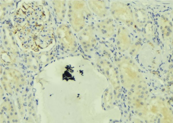 ULK1 Antibody - 1:100 staining mouse kidney tissue by IHC-P. The sample was formaldehyde fixed and a heat mediated antigen retrieval step in citrate buffer was performed. The sample was then blocked and incubated with the antibody for 1.5 hours at 22°C. An HRP conjugated goat anti-rabbit antibody was used as the secondary.