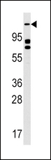 ULK2 Antibody - Western blot of anti-ULK2 Antibody in K562 cell line lysates (35 ug/lane). ULK2(arrow) was detected using the purified antibody.