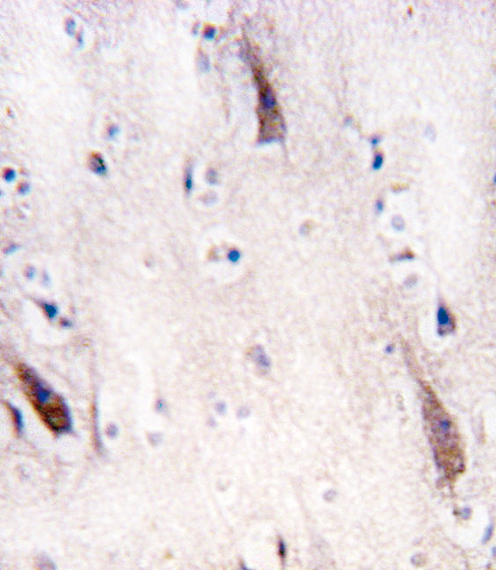ULK2 Antibody - Formalin-fixed and paraffin-embedded human brain tissue reacted with ULK2 antibody , which was peroxidase-conjugated to the secondary antibody, followed by DAB staining. This data demonstrates the use of this antibody for immunohistochemistry; clinical relevance has not been evaluated.