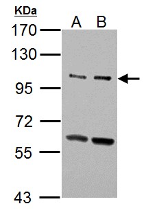 ULK2 Antibody - Sample (30 ug of whole cell lysate). A: NT2D1, B: PC-3. 7.5% SDS PAGE. ULK2 antibody diluted at 1:1000.