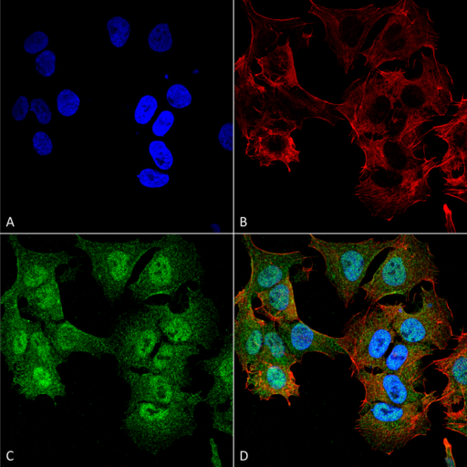 ULK2 Antibody - Immunocytochemistry/Immunofluorescence analysis using Rabbit Anti-ULK2 Polyclonal Antibody. Tissue: Neuroblastoma cell line (SK-N-BE). Species: Human. Fixation: 4% Formaldehyde for 15 min at RT. Primary Antibody: Rabbit Anti-ULK2 Polyclonal Antibody  at 1:100 for 60 min at RT. Secondary Antibody: Goat Anti-Rabbit ATTO 488 at 1:200 for 60 min at RT. Counterstain: Phalloidin Texas Red F-Actin stain; DAPI (blue) nuclear stain at 1:1000, 1:5000 for 60 min at RT, 5 min at RT. Localization: Cytoplasmic Vesicle Membrane, Peripheral Membrane Protein. Magnification: 60X. (A) DAPI (blue) nuclear stain (B) Phalloidin Texas Red F-Actin stain (C) ULK2 Antibody (D) Composite.