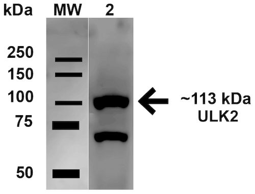 ULK2 Antibody - Western blot analysis of Rat brain showing detection of 112.7 kDa ULK2 protein using Rabbit Anti-ULK2 Polyclonal Antibody. Lane 1: Molecular Weight Ladder (MW). Lane 2: Rat brain lysates. Load: 15 µg. Block: 5% Skim Milk in 1X TBST. Primary Antibody: Rabbit Anti-ULK2 Polyclonal Antibody  at 1:1000 for 1 hour at RT. Secondary Antibody: Goat Anti-Rabbit HRP at 1:2000 for 60 min at RT. Color Development: ECL solution for 6 min in RT. Predicted/Observed Size: 112.7 kDa. Other Band(s): ~70 kDa.