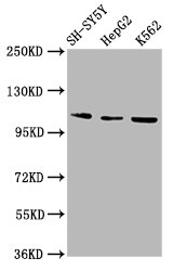 ULK2 Antibody - Western Blot Positive WB detected in: SH-SY5Y whole cell lysate, HepG2 whole cell lysate, K562 whole cell lysate All Lanes: ULK2 antibody at 2.9µg/ml Secondary Goat polyclonal to rabbit IgG at 1/50000 dilution Predicted band size: 113 KDa Observed band size: 113 KDa