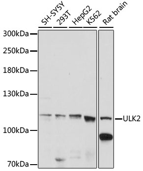 ULK2 Antibody - Western blot analysis of extracts of various cell lines, using ULK2 antibody at 1:1000 dilution. The secondary antibody used was an HRP Goat Anti-Rabbit IgG (H+L) at 1:10000 dilution. Lysates were loaded 25ug per lane and 3% nonfat dry milk in TBST was used for blocking. An ECL Kit was used for detection and the exposure time was 5s.