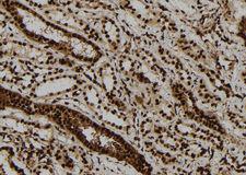 ULK2 Antibody - 1:100 staining human kidney tissue by IHC-P. The sample was formaldehyde fixed and a heat mediated antigen retrieval step in citrate buffer was performed. The sample was then blocked and incubated with the antibody for 1.5 hours at 22°C. An HRP conjugated goat anti-rabbit antibody was used as the secondary.