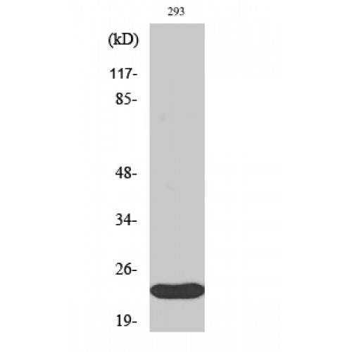 ULK3 Antibody - Western blot of ULK3 antibody