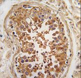 ULK3 Antibody - Formalin-fixed and paraffin-embedded human testis tissue reacted with *ULK3 antibody , which was peroxidase-conjugated to the secondary antibody, followed by DAB staining. This data demonstrates the use of this antibody for immunohistochemistry; clinical relevance has not been evaluated.