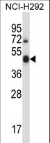 ULK3 Antibody - Mouse Ulk3 Antibody western blot of NCI-H292 cell line lysates (35 ug/lane). The Ulk3 antibody detected the Ulk3 protein (arrow).