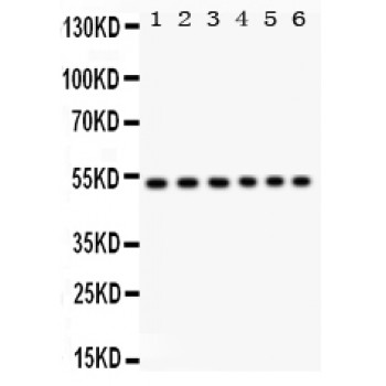 ULK3 Antibody - ULK3 antibody Western blot. All lanes: Anti ULK3 at 0.5 ug/ml. Lane 1: Rat Brain Tissue Lysate at 50 ug. Lane 2: Rat Testis Tissue Lysate at 50 ug. Lane 3: Mouse Brain Tissue Lysate at 50 ug. Lane 4: Human Placenta Tissue Lysate at 50 ug. Lane 5: 22RV1 Whole Cell Lysate at 40 ug. Lane 6: SMMC Whole Cell Lysate at 40 ug. Predicted band size: 53 kD. Observed band size: 53 kD.