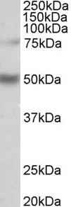 ULK3 Antibody - ULK3 antibody (1 ug/ml) staining of Human Hippocampus lysate (35 ug protein in RIPA buffer). Primary incubation was 1 hour. Detected by chemiluminescence.
