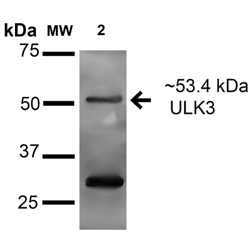 ULK3 Antibody - Western blot analysis of Human Lung carcinoma epithelial cell line (A549) lysate showing detection of 53.4 kDa ULK3 protein using Rabbit Anti-ULK3 Polyclonal Antibody. Lane 1: Molecular Weight Ladder (MW). Lane 2: Human A549 cell lysates. Load: 15 µg. Block: 2% BSA and 2% Skim Milk in 1X TBST. Primary Antibody: Rabbit Anti-ULK3 Polyclonal Antibody  at 1:1000 for 16 hours at 4°C. Secondary Antibody: Goat Anti-Rabbit IgG: HRP at 1:2000 for 60 min at RT. Color Development: ECL solution for 6 min in RT. Predicted/Observed Size: 53.4 kDa. Other Band(s): ~25 kDa in all lysates.