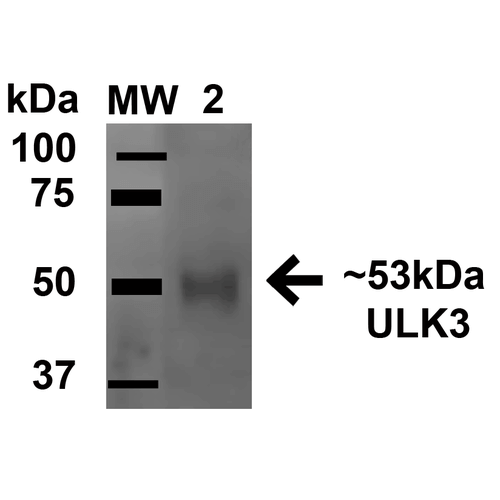 ULK3 Antibody - Western blot analysis of Human HeLa lysates showing detection of 53.4 kDa ULK3 protein using Rabbit Anti-ULK3 Polyclonal Antibody. Lane 1: Molecular Weight Ladder (MW). Lane 2: HeLa lysates. Load: 15 µg. Block: 5% Skim Milk in 1X TBST. Primary Antibody: Rabbit Anti-ULK3 Polyclonal Antibody  at 1:1000 for 1 hour at RT. Secondary Antibody: Goat Anti-Rabbit HRP at 1:2000 for 60 min at RT. Color Development: ECL solution for 6 min in RT. Predicted/Observed Size: 53.4 kDa.