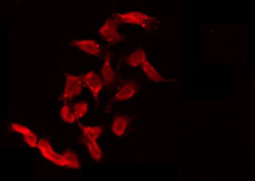 ULK3 Antibody - Staining 293 cells by IF/ICC. The samples were fixed with PFA and permeabilized in 0.1% Triton X-100, then blocked in 10% serum for 45 min at 25°C. The primary antibody was diluted at 1:200 and incubated with the sample for 1 hour at 37°C. An Alexa Fluor 594 conjugated goat anti-rabbit IgG (H+L) Ab, diluted at 1/600, was used as the secondary antibody.