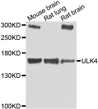 ULK4 Antibody - Western blot analysis of extracts of various cell lines.
