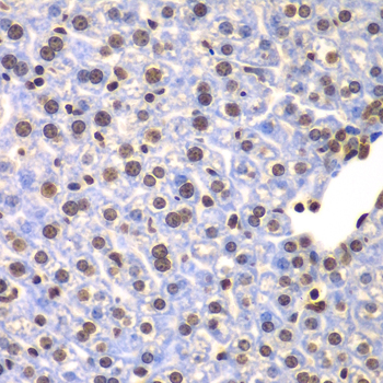 ULK4 Antibody - Immunohistochemistry of paraffin-embedded mouse liver tissue.