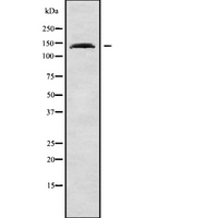 ULK4 Antibody - Western blot analysis ULK4 using Jurkat whole cells lysates