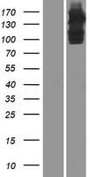 ULK4 Protein - Western validation with an anti-DDK antibody * L: Control HEK293 lysate R: Over-expression lysate