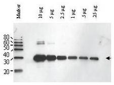 ULP1 Antibody - Anti-Yeast ULP-1 Antibody - Western Blot. Western blot of Affinity Purified anti-Yeast ULP-1 antibody shows detection of a truncated ULP-1 fusion protein (arrowhead). Increasing concentrations of yeast ULP-1 were run on a SDS-PAGE, transferred onto nitrocellulose, and blocked for 1 hour with 5% non-fat dry milk in TTBS, and probed overnight at 4C with a 1:1000 dilution of anti-yULP-1 antibody in 5% non-fat dry milk in TTBS. Detection occurred using a 1:1000 dilution of HRP-labeled Donkey anti-Rabbit IgG for 1 hour at room temperature. A chemiluminescence system was used for signal detection (Roche) using a 3-sec exposure time.