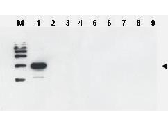 ULP1 Antibody - Anti-Yeast ULP-1 Antibody - Western Blot. Western blot of Affinity Purified anti-Yeast ULP-1 antibody was used to confirm the specificity of the antibody. SDS-PAGE of 2 ug of ULP-1 homologues from other sources (lanes 2 through 9). After blocking for 1 hour with 5% non-fat dry milk in TTBS, the blot was probed overnight at 4C with a 1:1000 dilution of anti-yULP1 antibody detected as above. This antibody is specific for yeast ULP1 and does not react with ULP1 from related sources including human SENP.