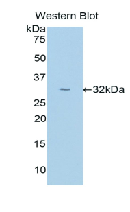 UMOD / Uromodulin Antibody - Western blot of recombinant UMOD / Uromodulin.  This image was taken for the unconjugated form of this product. Other forms have not been tested.