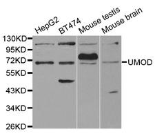 UMOD / Uromodulin Antibody - Western blot analysis of extracts of various cell lines.