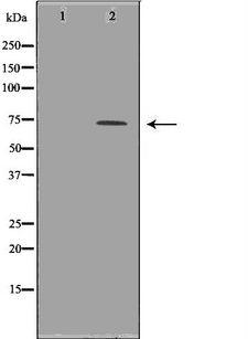UMOD / Uromodulin Antibody - Western blot analysis of extracts of MDA-MB453 using UMOD antibody. The lane on the left is treated with the antigen-specific peptide.