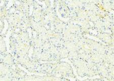UMOD / Uromodulin Antibody - 1:100 staining mouse kidney tissue by IHC-P. The sample was formaldehyde fixed and a heat mediated antigen retrieval step in citrate buffer was performed. The sample was then blocked and incubated with the antibody for 1.5 hours at 22°C. An HRP conjugated goat anti-rabbit antibody was used as the secondary.