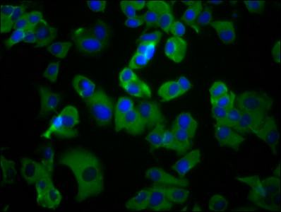 UMODL1 Antibody - Immunofluorescence staining of MCF-7 cells diluted at 1:100, counter-stained with DAPI. The cells were fixed in 4% formaldehyde, permeabilized using 0.2% Triton X-100 and blocked in 10% normal Goat Serum. The cells were then incubated with the antibody overnight at 4°C.The Secondary antibody was Alexa Fluor 488-congugated AffiniPure Goat Anti-Rabbit IgG (H+L).