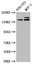 UMODL1 Antibody - Western Blot Positive WB detected in: NIH/3T3 whole cell lysate, MCF-7 whole cell lysate All Lanes: UMODL1 antibody at 5.1µg/ml Secondary Goat polyclonal to rabbit IgG at 1/50000 dilution Predicted band size: 145, 157, 137, 150 KDa Observed band size: 145, 157 KDa